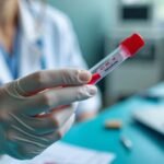 Understanding MPV in Blood Tests: What You Need to Know